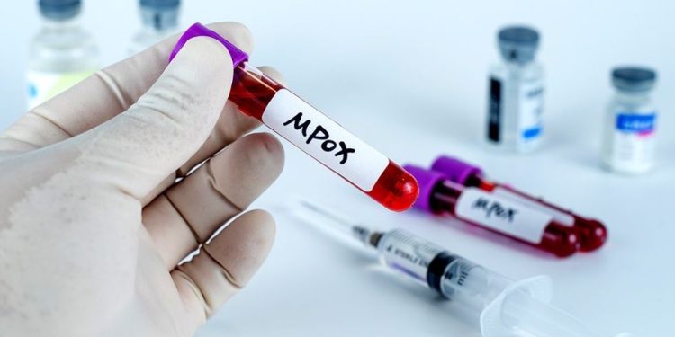 GHS confirms 37 new Mpox cases, total now 409