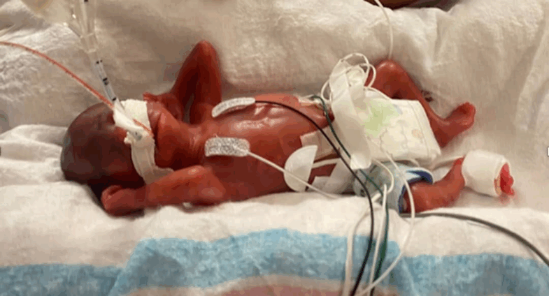 128,000 babies born prematurely in Ghana annually -WHO