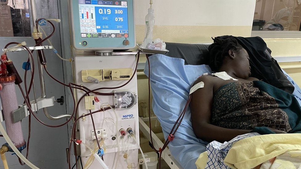 Renal Patients Association backs fast-tracking of organ transplant bill